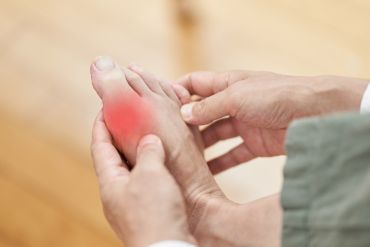 Gout Infusion Treatments 